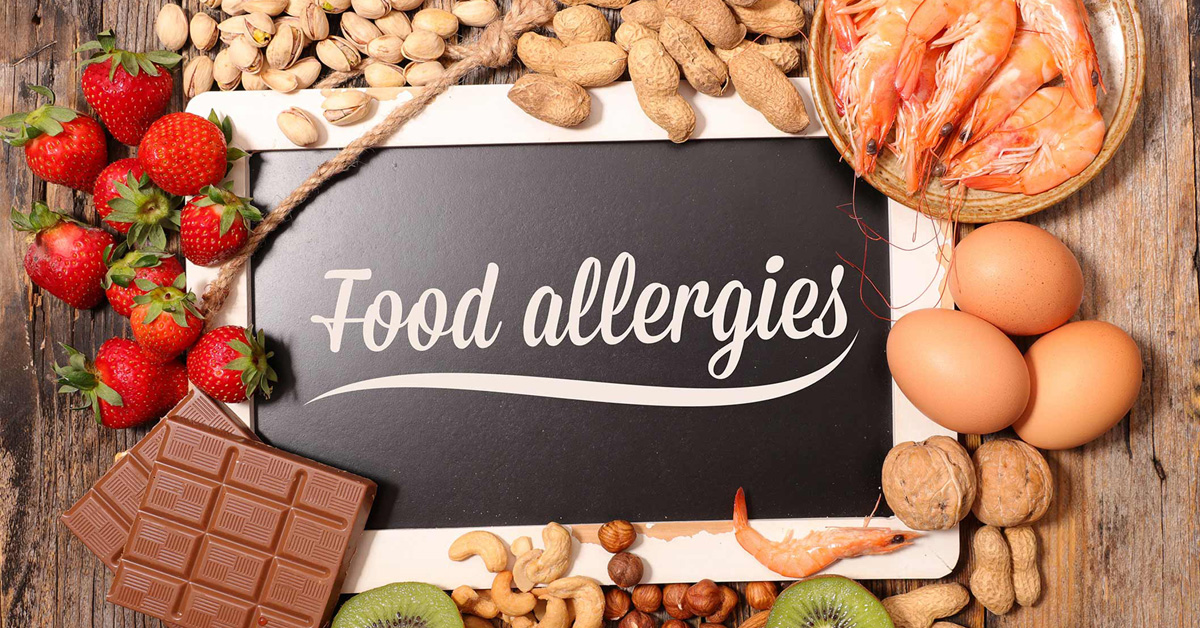 Food allergies - what you need to know.